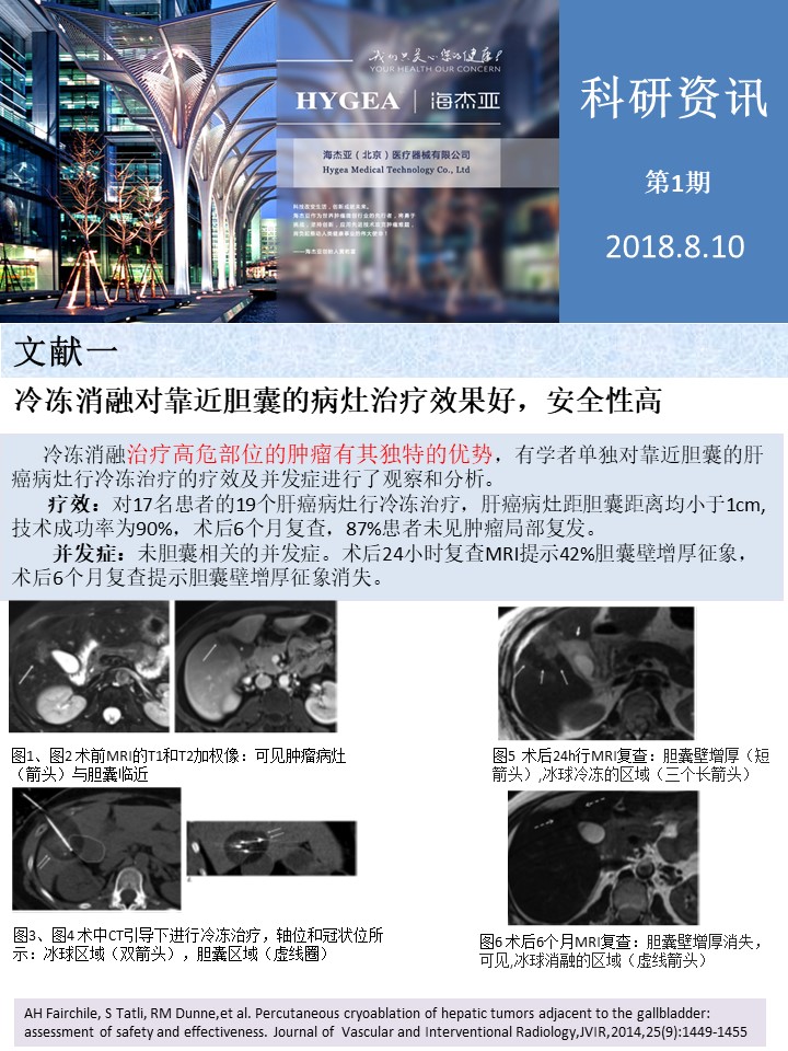 【海杰亞科研資訊】第1期——肝、肺癌消融